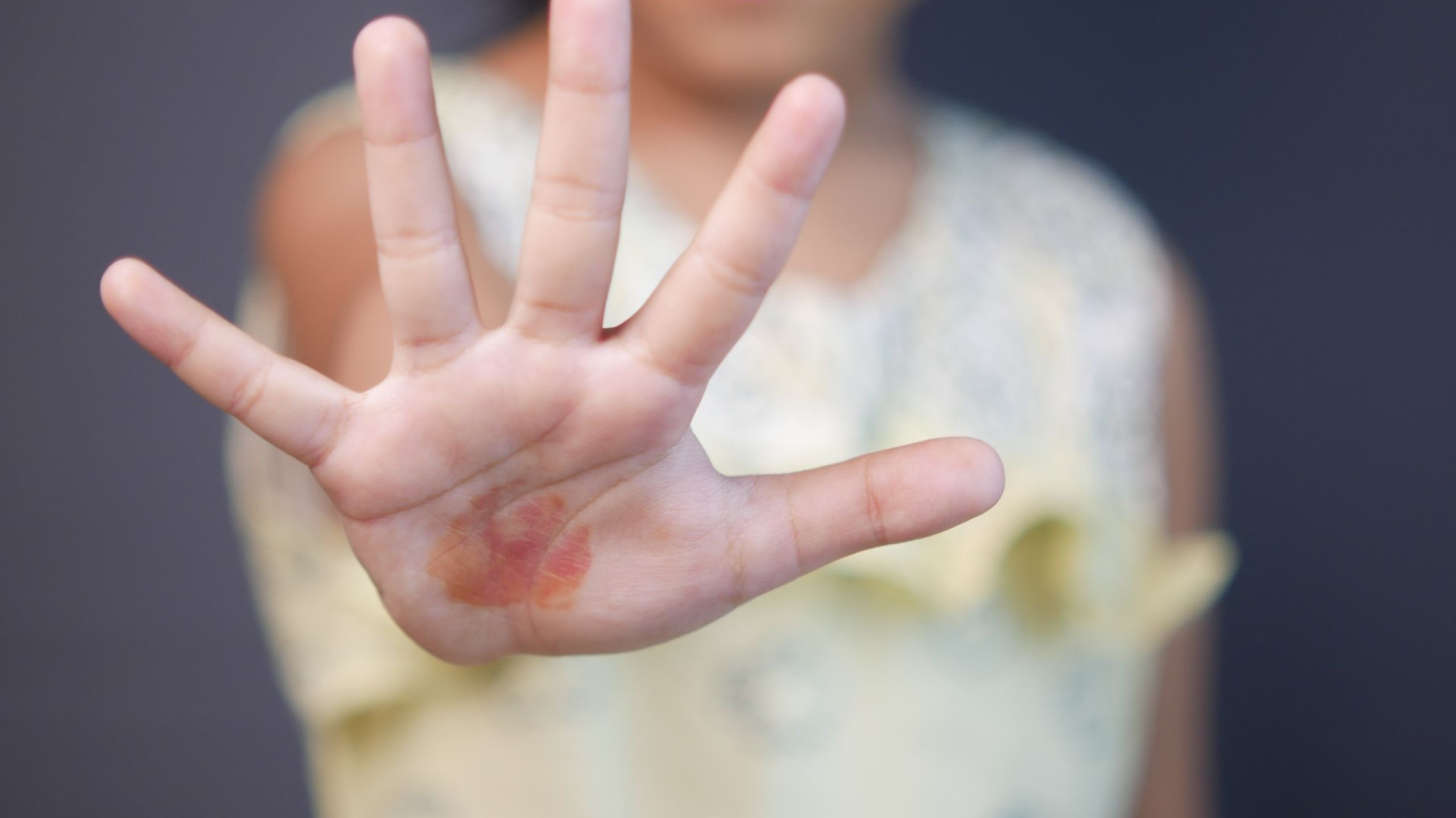 Confermato “Vos estis lux mundi”, la procedura contro gli abusi